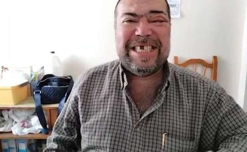 Carlos perdió un diente en la caída y tiene graves daños en ojo izquierdo/C7.